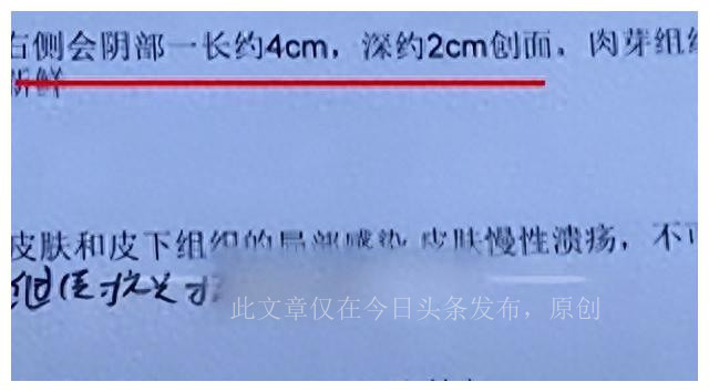 太惨了,湖北女幼师被咬隐私部位,狗主人拒赔,女子:我怎么嫁人