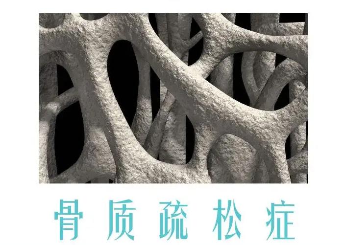 儿童骨密度检测中bmi正常范围,34岁骨密度检测说骨质疏松怎么办