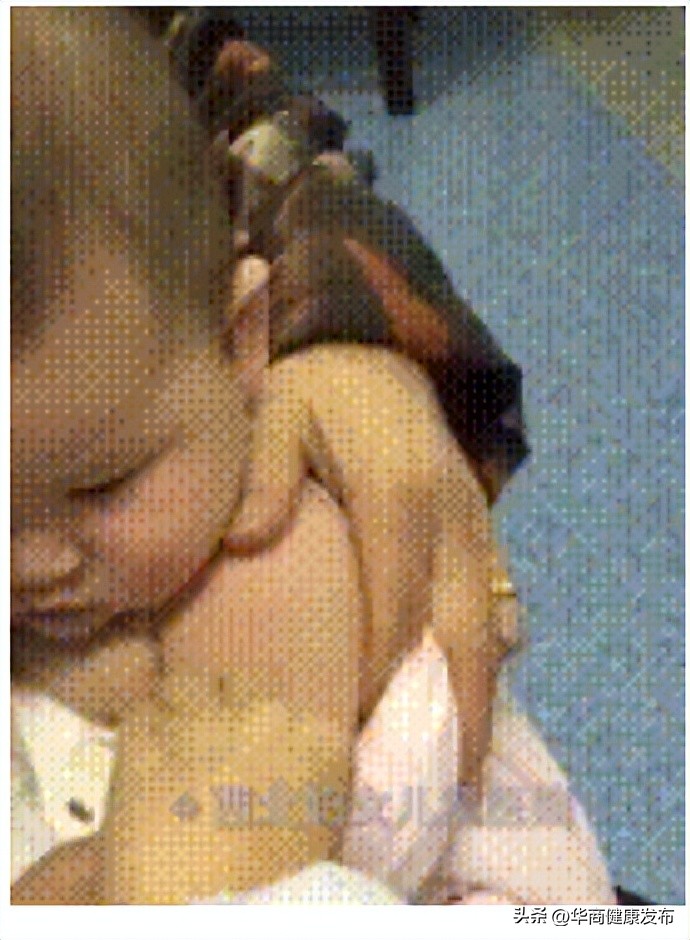 怎么知道曾经种过卡介苗,卡介苗长大后能补种吗