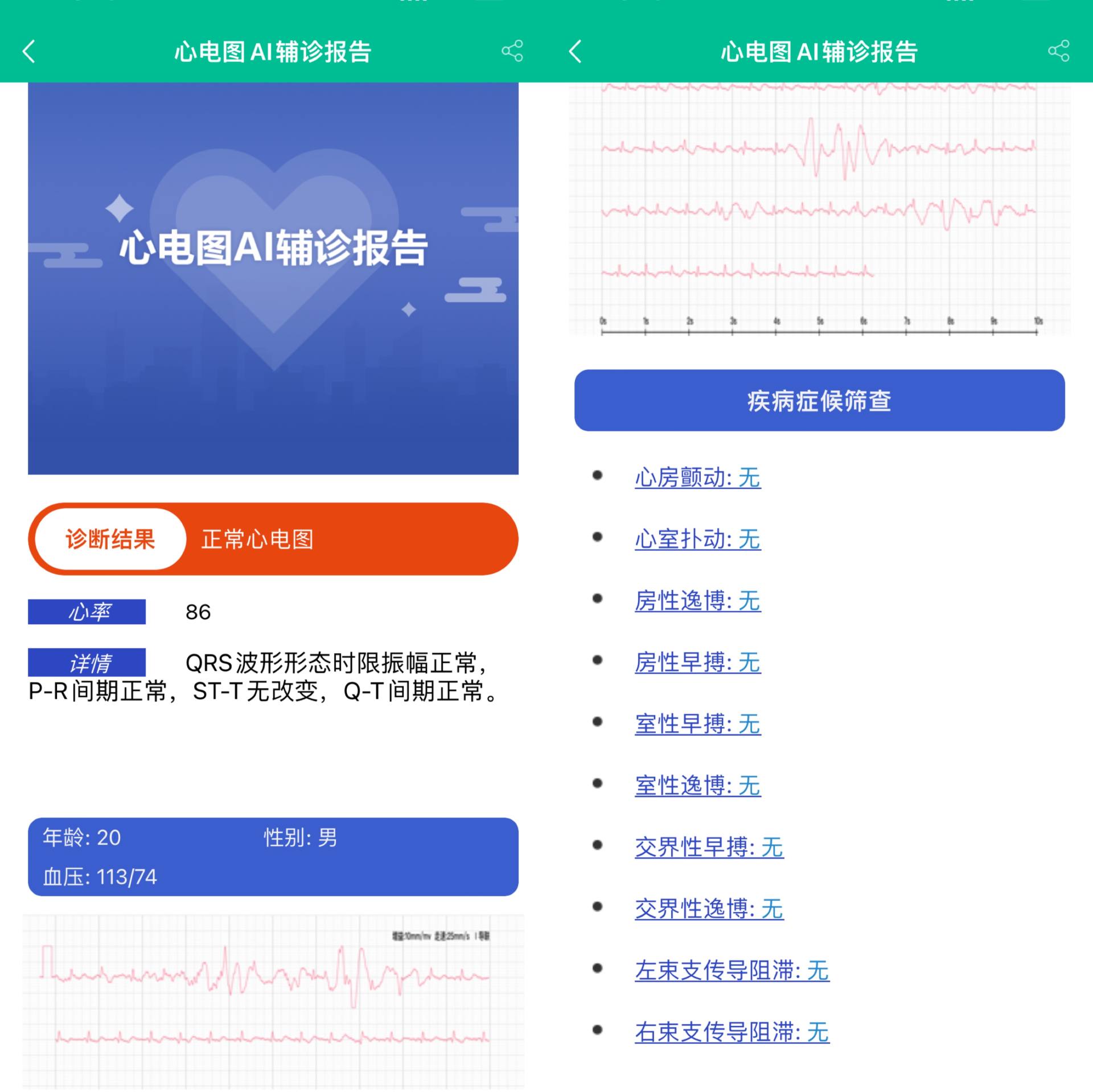 心率血氧监测智能手表哪款好用,监测血压和心率的智能手表排名