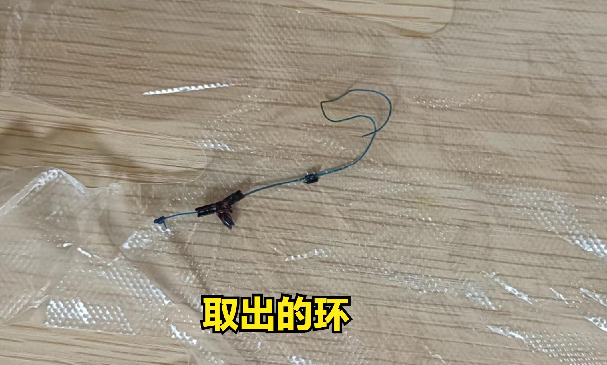 有没有最快的取环方法,取环大多数要几分钟啊