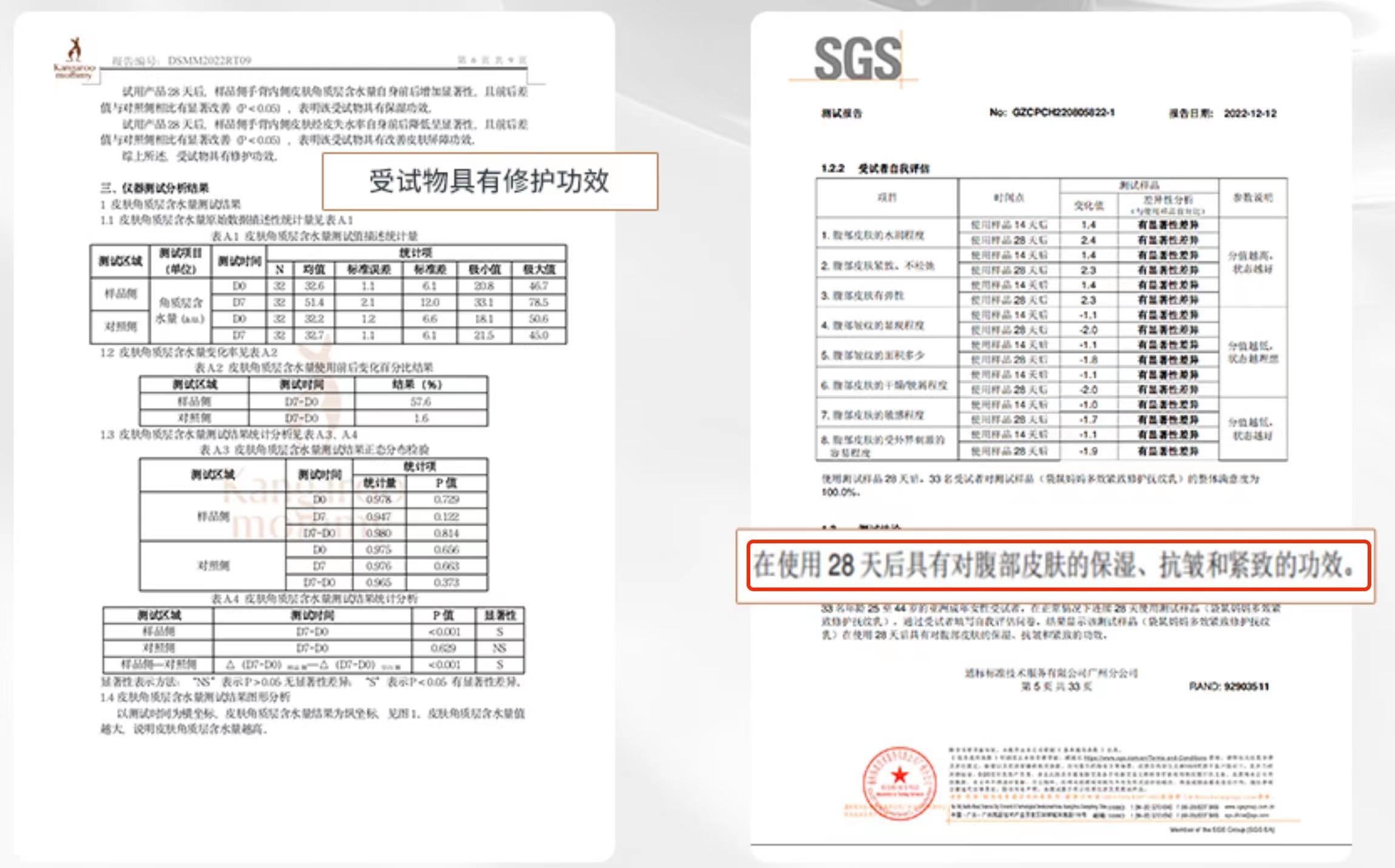 妊娠纹十大必买产品,什么妊娠油淡纹效果好