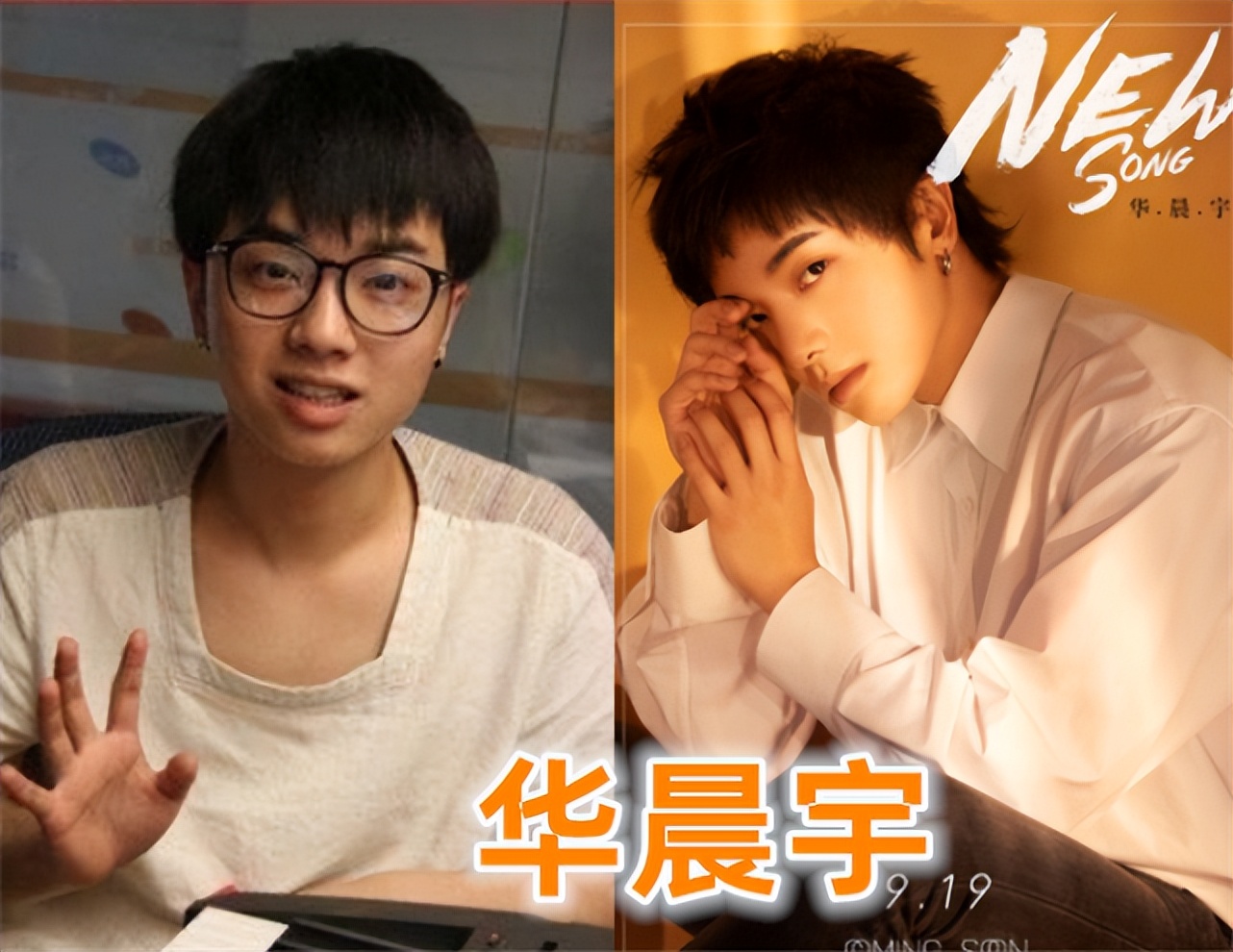 过度医美失败的男明星照片,医美过度的男明星有多吓人