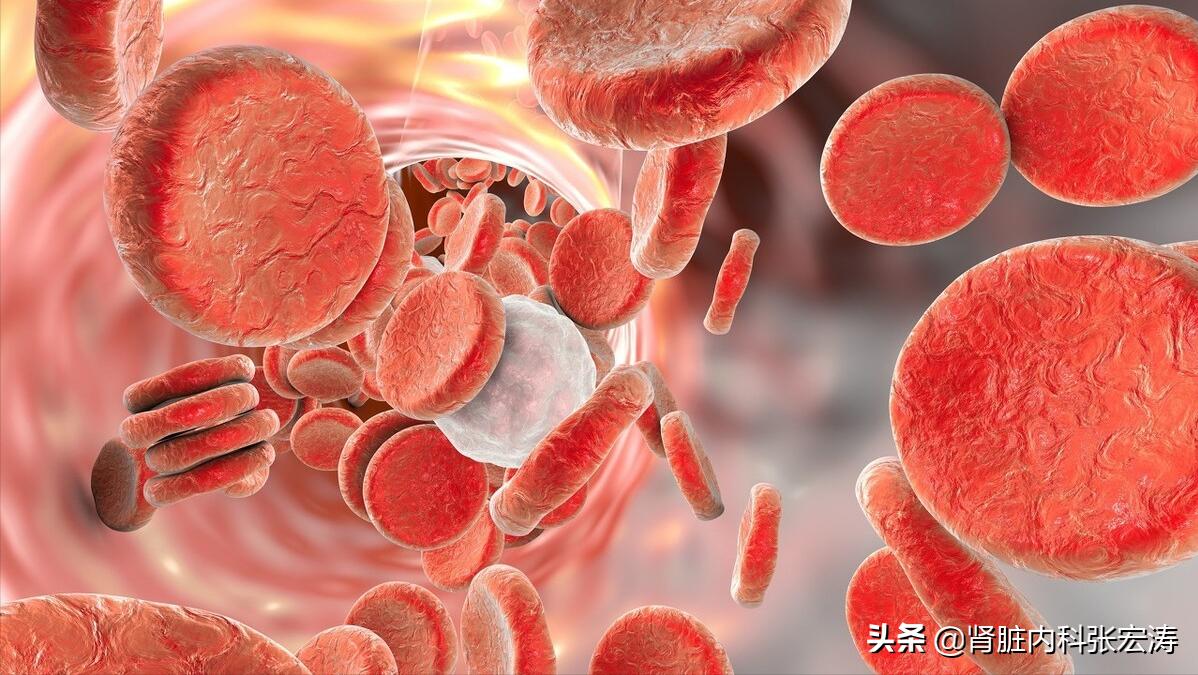 肾穿刺到底有多疼,肾穿刺是怎么穿刺的