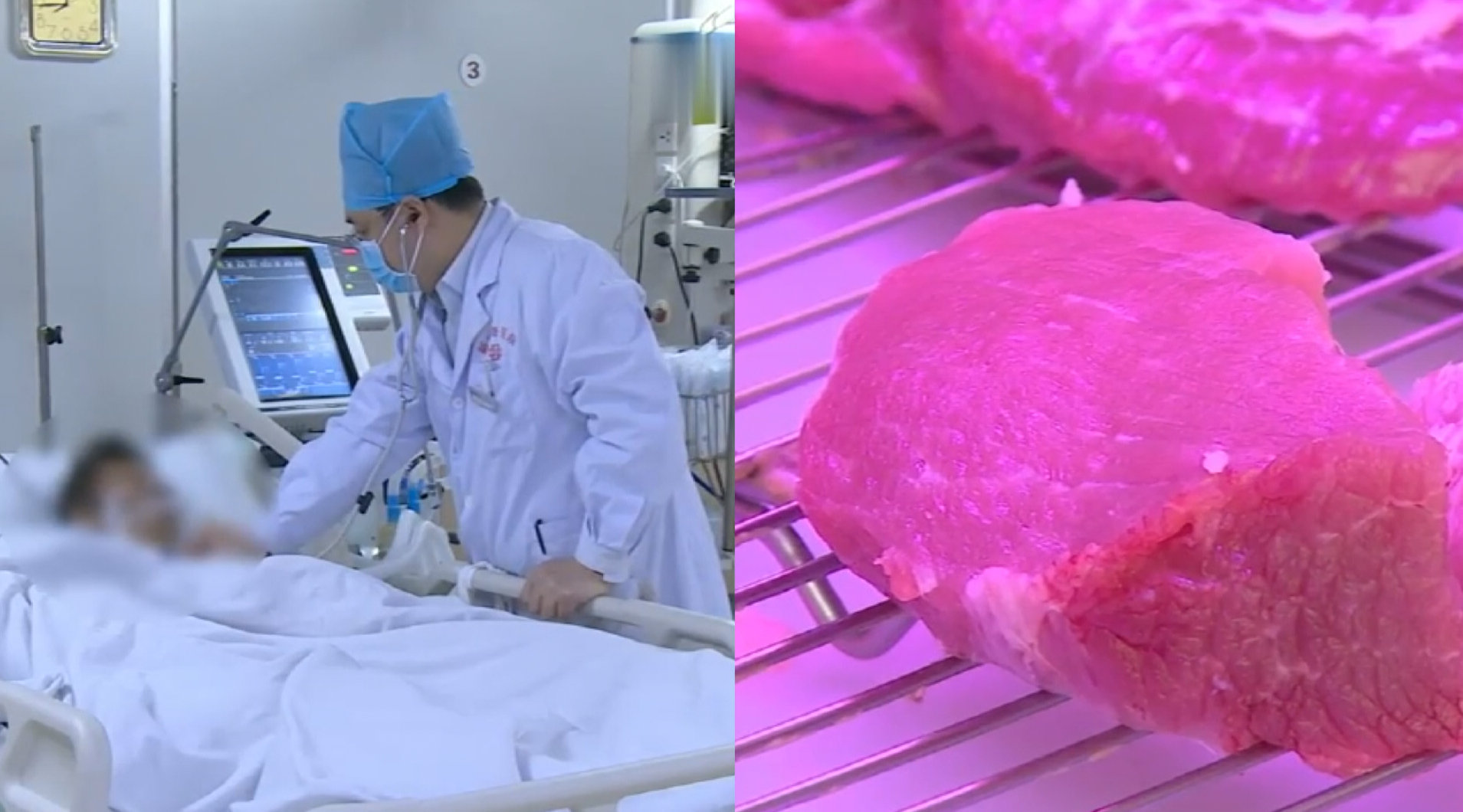 厨师接触生猪肉后感染罕见病,高烧不退神智不清,还住进了ICU