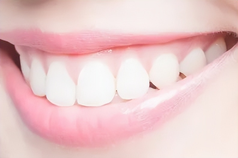 牙齿贴面什么材质经济又耐用,牙齿瓷贴面哪家做的好