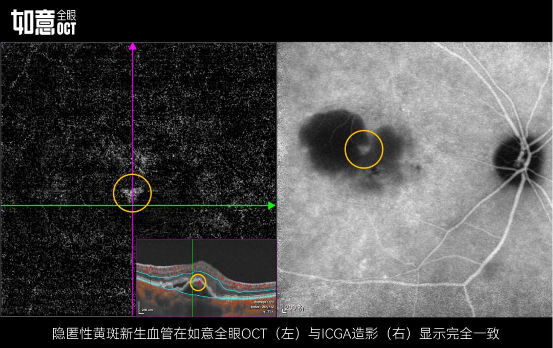 惠民眼科医院,惠民中心医院眼科