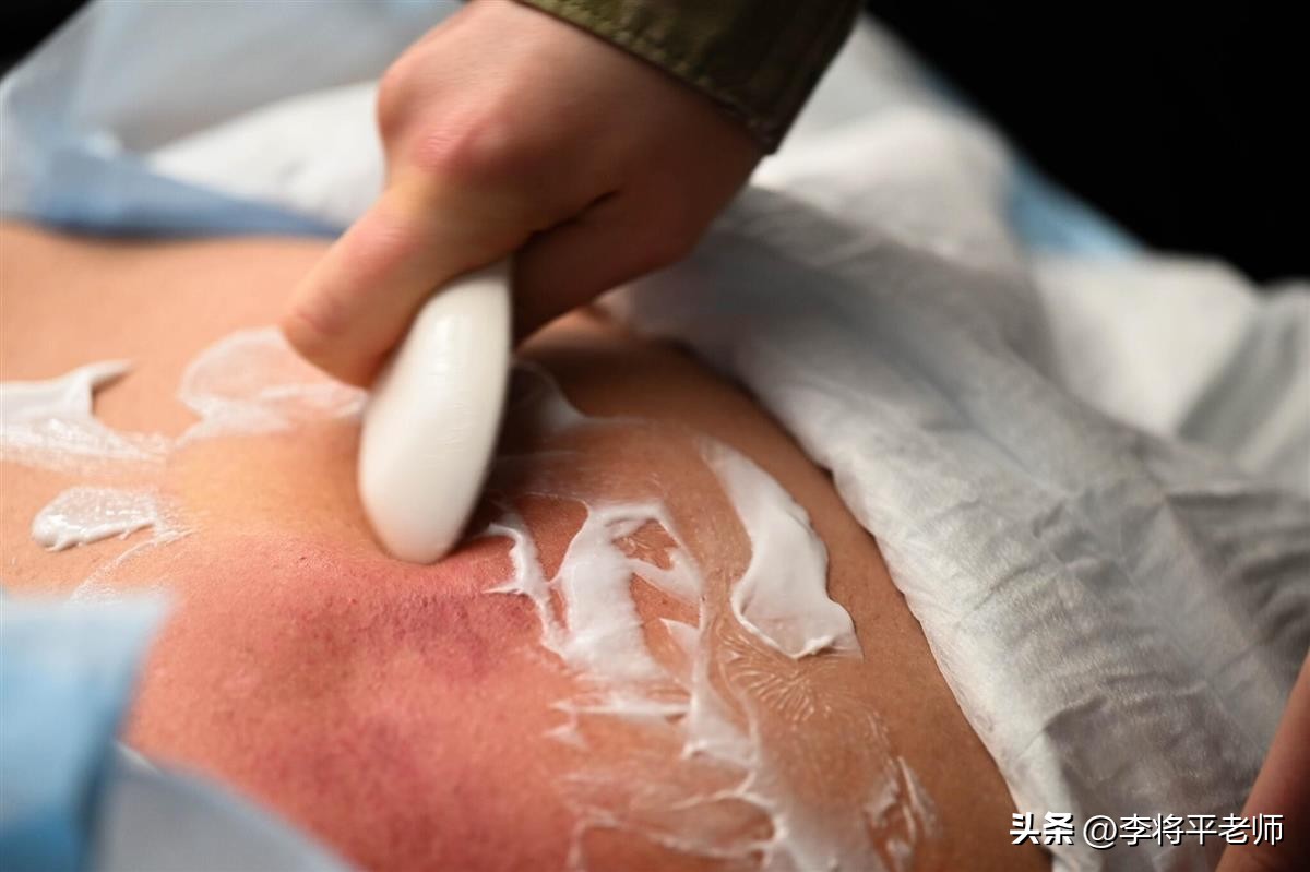 美国士兵拔火罐,美军晒拔火罐照片