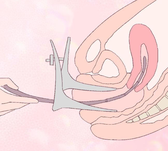 正经的女生有哪些表现,正经女人会得妇科病吗