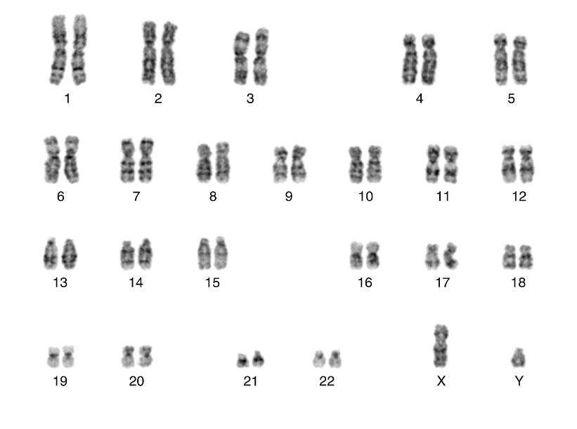 阴阳人有精子和卵子吗,阴阳人的存在
