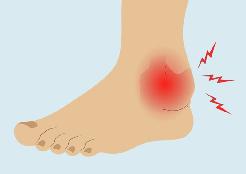 习惯性崴脚踝关节咔咔响怎么治疗,习惯性崴脚加强踝关节力量有用吗