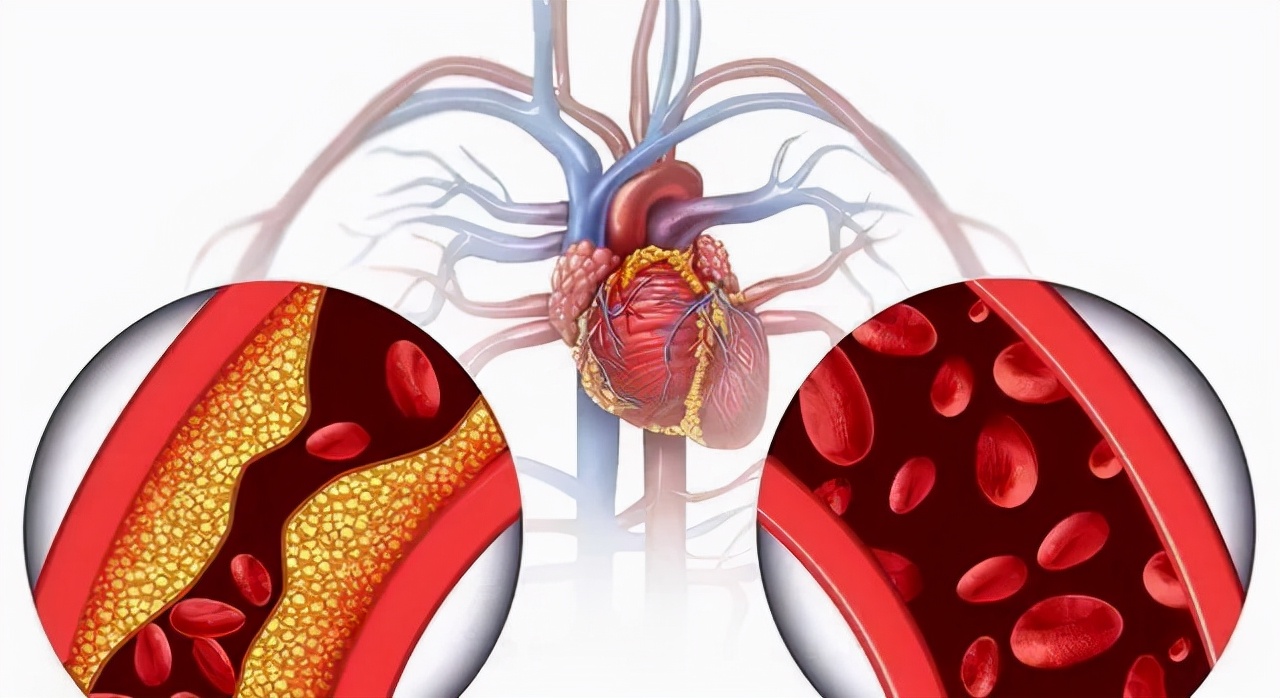 进口瑞舒伐他汀价格是多少,瑞舒伐他汀5毫克进口