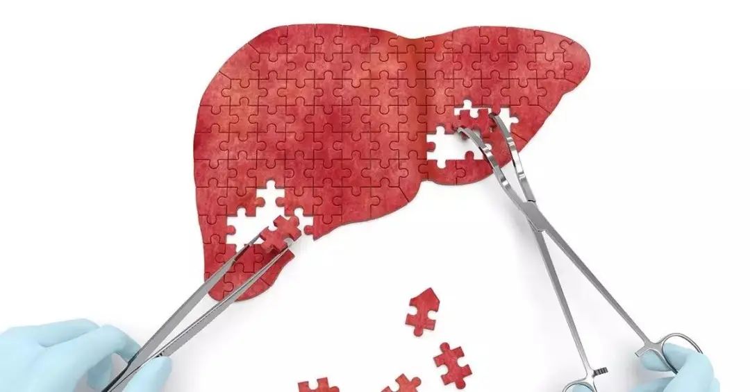 肝移植手术后出院注意什么,肝移植后出现并发症需要怎么护理