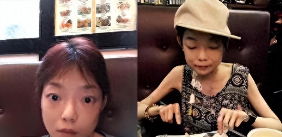 瘦到病态的审美,瘦到病态