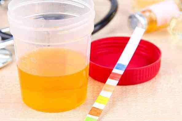 糖尿病引起的尿毒症后期会怎样,糖尿病人尿太多会出现什么症状