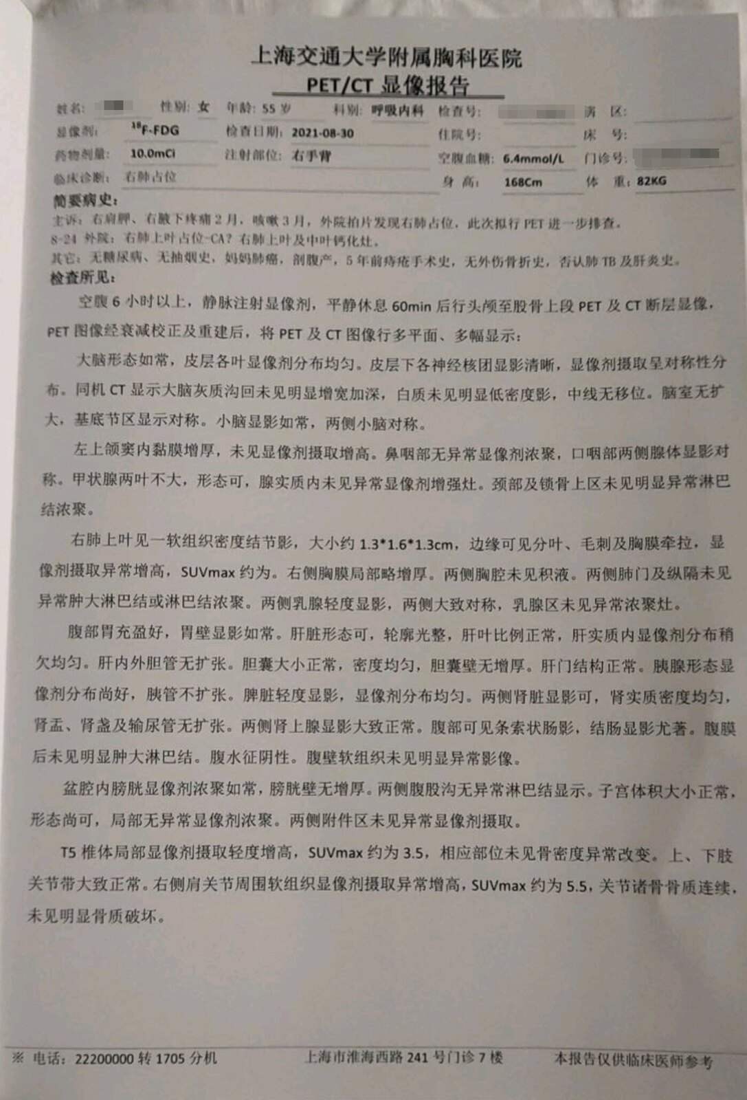 刘懿博士说肺癌微浸润复发,实性结节早期肺癌可以治好吗