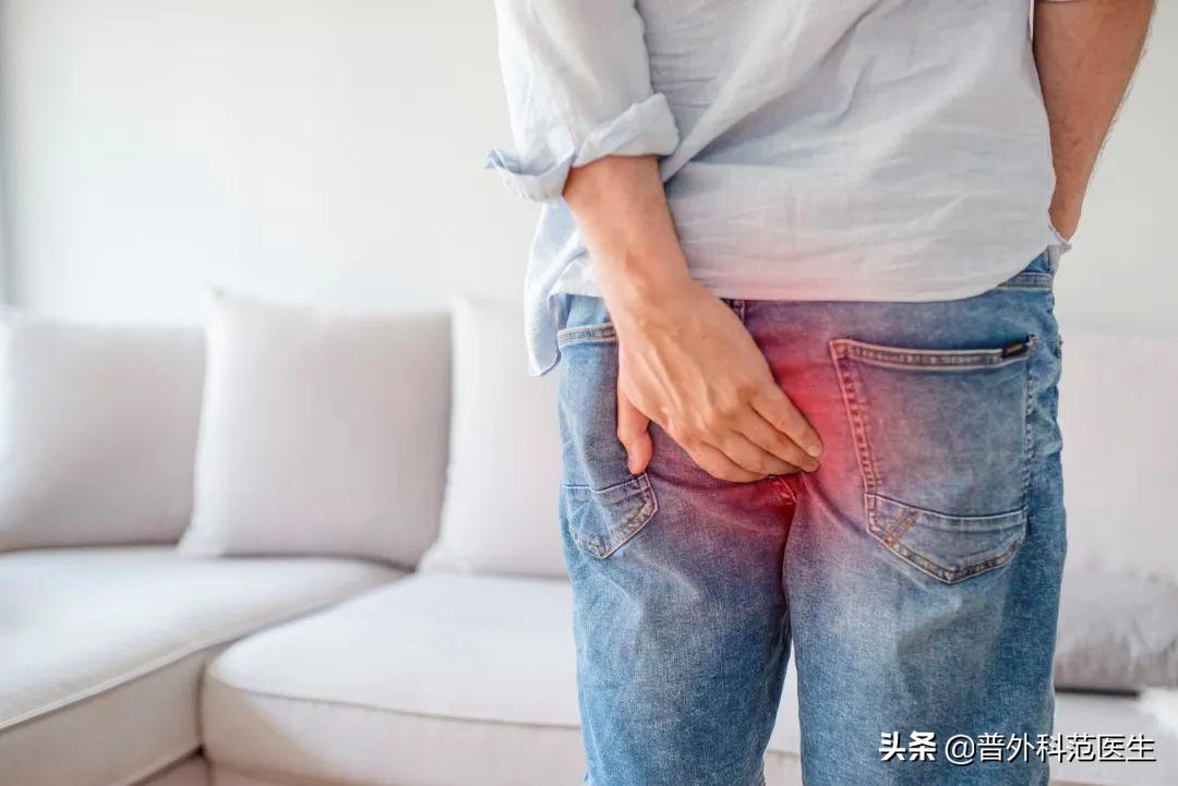 菊花痒该忍还是该挠？