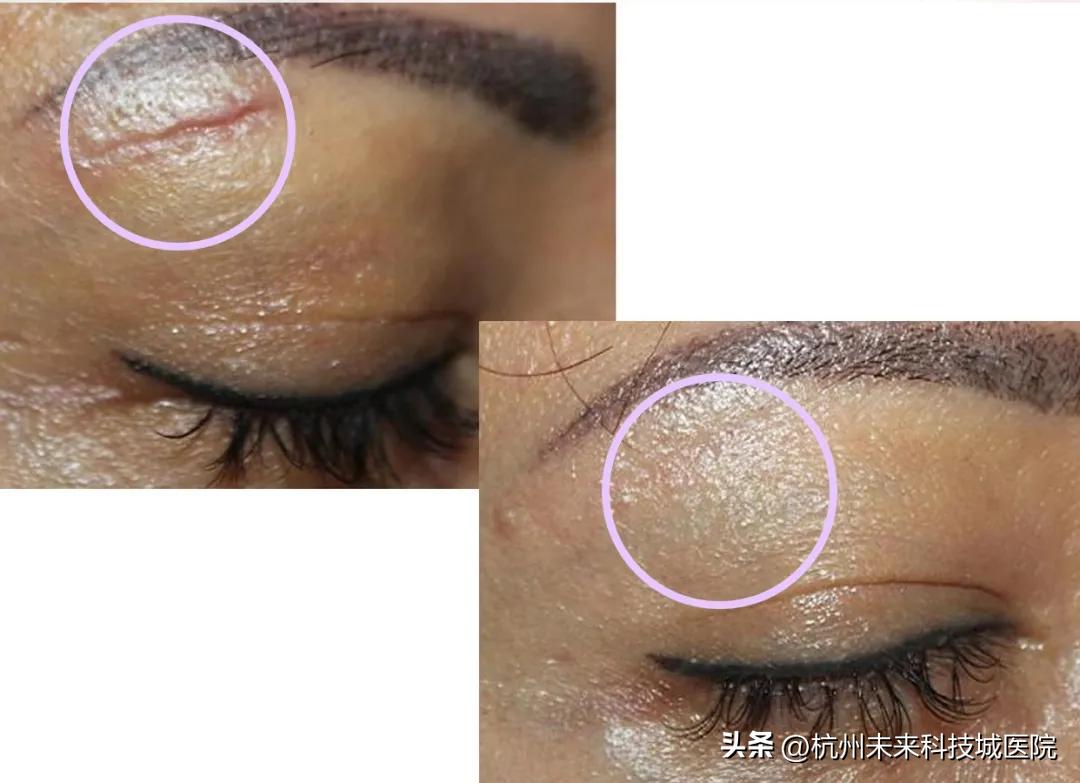 不追求一个模板的复制美|17年专注年轻化专家