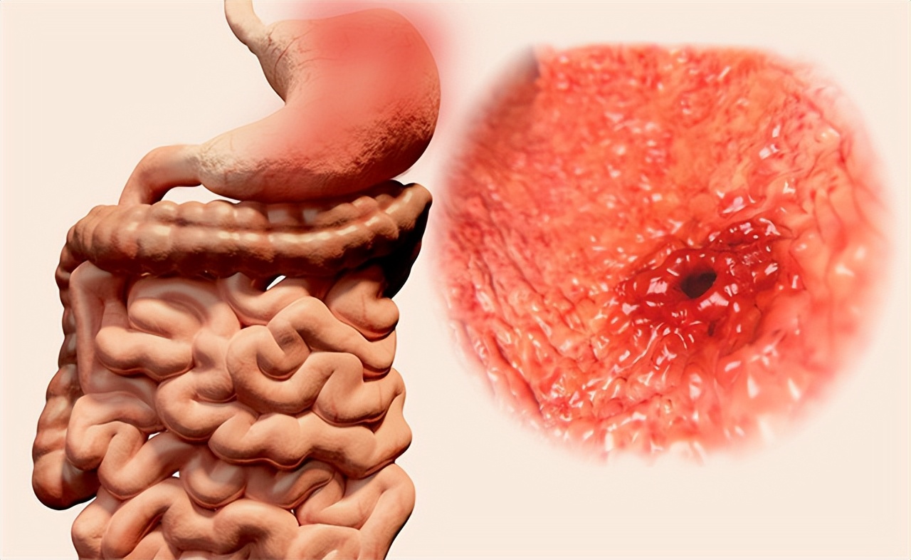 吃水果对胃病有害吗,经常吃水果吃得多会导致胃病吗