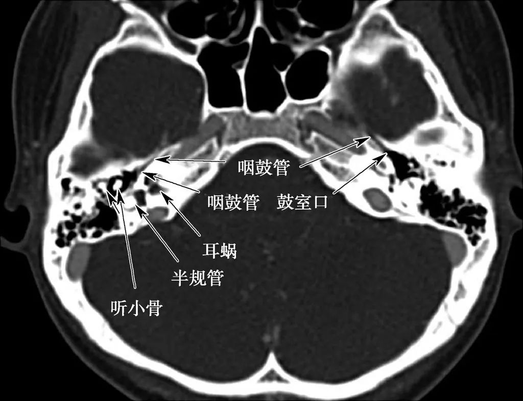 耳部解剖结构和生理功能,耳部解剖笔记