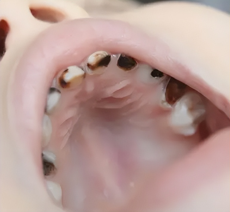 牙科恐惧症如何缓解,牙科焦虑症和牙科畏惧症