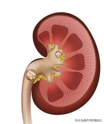 尿酸高的七个征兆官方,尿酸高的症状征兆