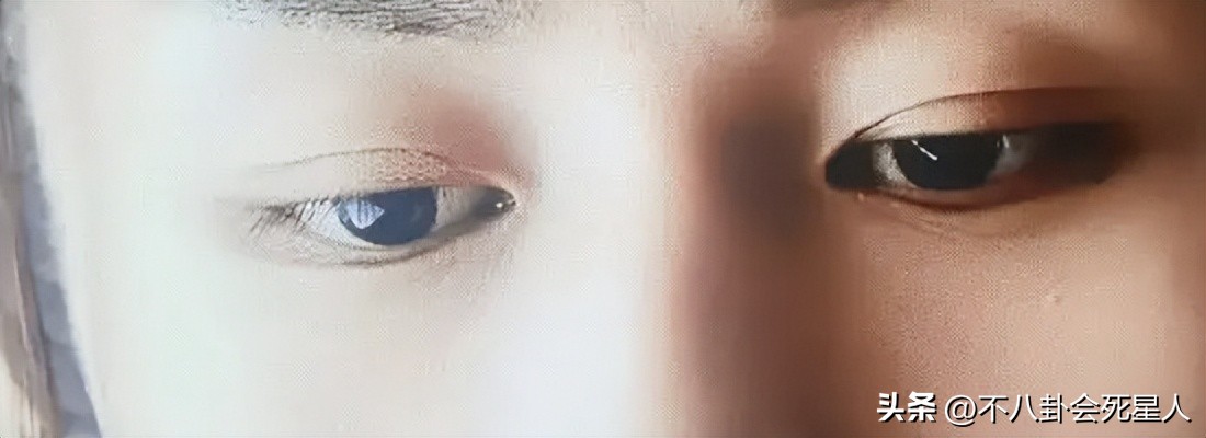 假双眼皮的明星,明星的假脸