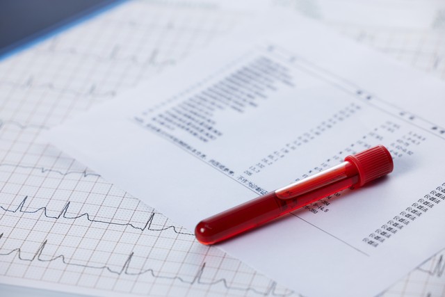 高血压三项立位检查需要注意啥,检查高血压的三项是什么