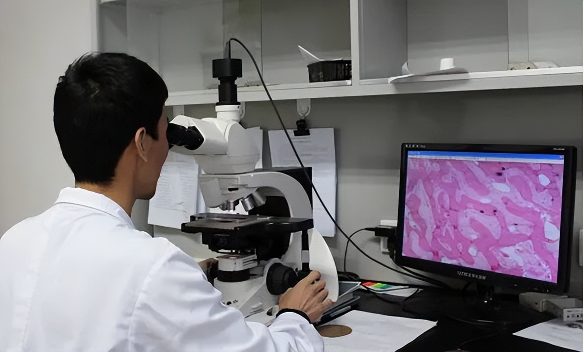 头上长了红色斑要注意了,头上有斑块怎么治