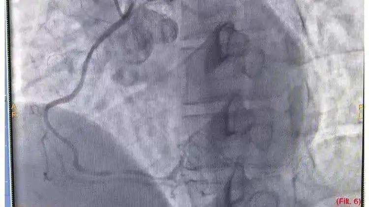 心血管疾病公益活动方案,榆林市星元医院支援政策