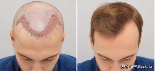 头发理疗，浑水状态下获客/复购都是难题