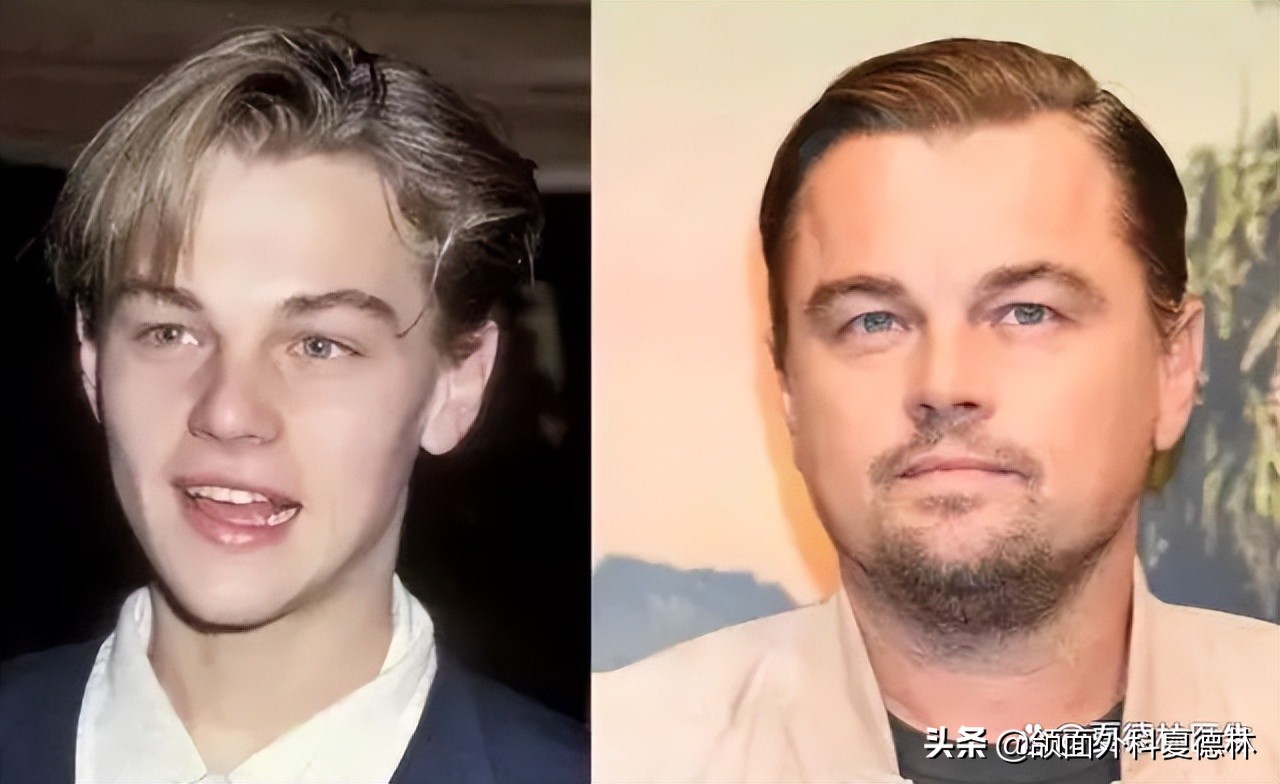 如何预防脸发腮,什么样的脸容易发腮