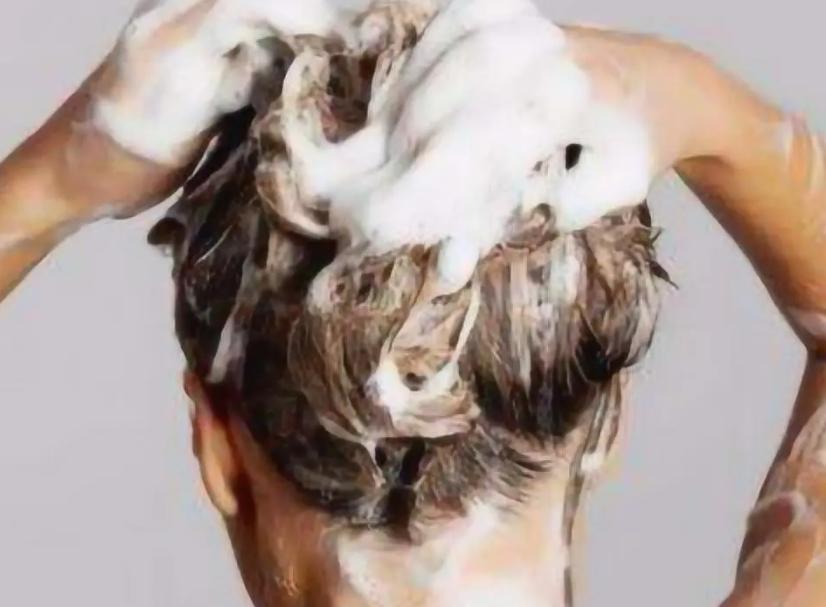 什么产品治脱发秃头最好,头皮护理能治脱发吗