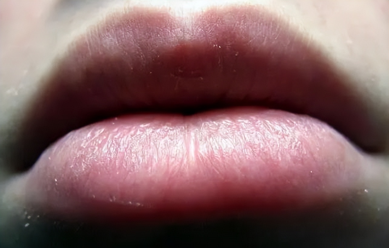 咳出黑痰黄痰白痰分别代表什么,痰是绿色的提示什么病