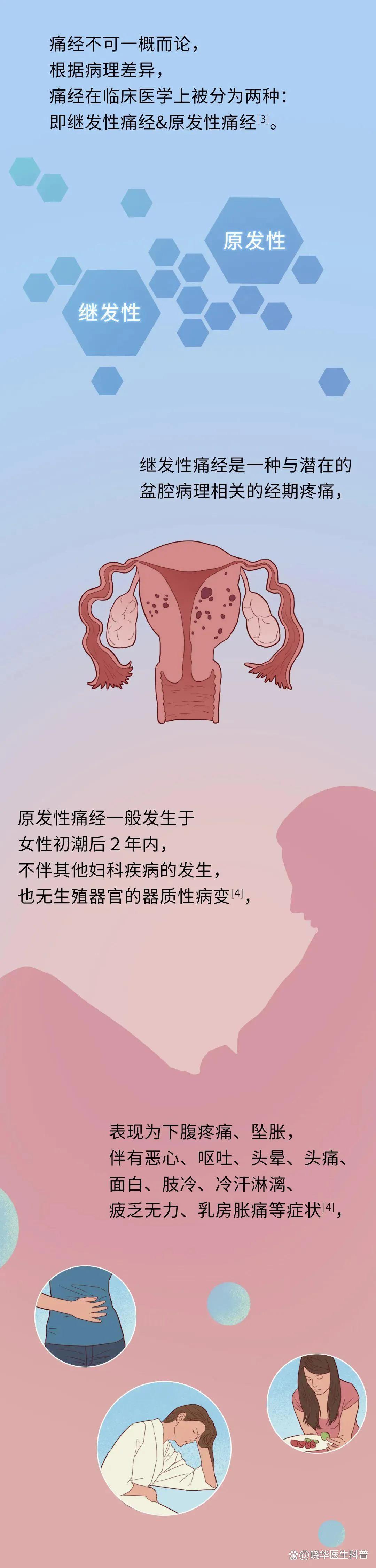「姨妈痛」是一种什么“体验”？一组漫画揭露真相，女孩子都懂