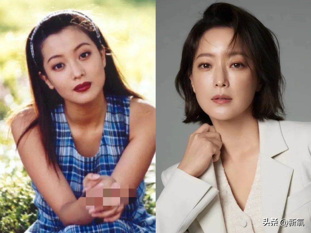 高颅顶怎么掩饰发际线,高颅顶会显得发际线低吗