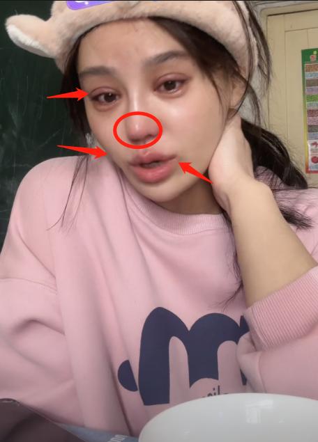 整容失败的女星蛇精脸,女星整容失败脸歪嘴斜