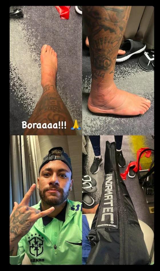 内马尔分享了受伤脚踝照片,这继续让巴西担心