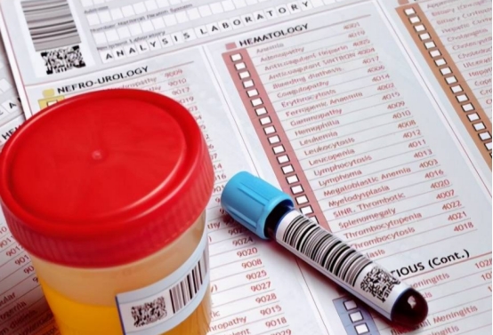 国产降压新药阿利沙坦酯,降压药阿利沙坦酯片的副作用