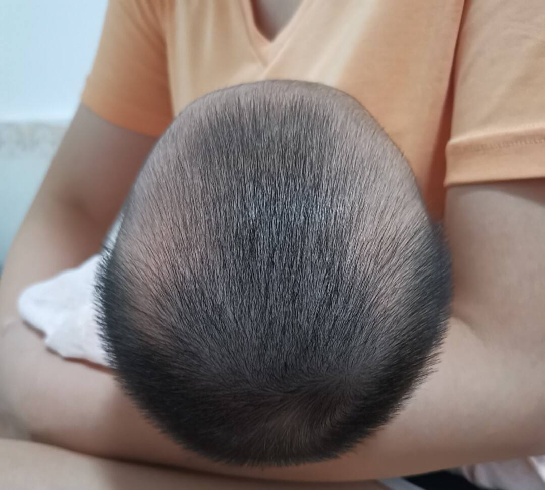 怎么让宝宝的头型睡正有什么方法,宝宝头型两边高低不一样怎么睡