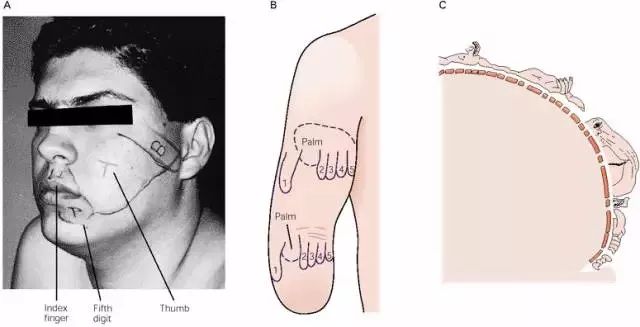 幻肢、恋足是心理出现问题吗？这些行为的背后大脑都有解释