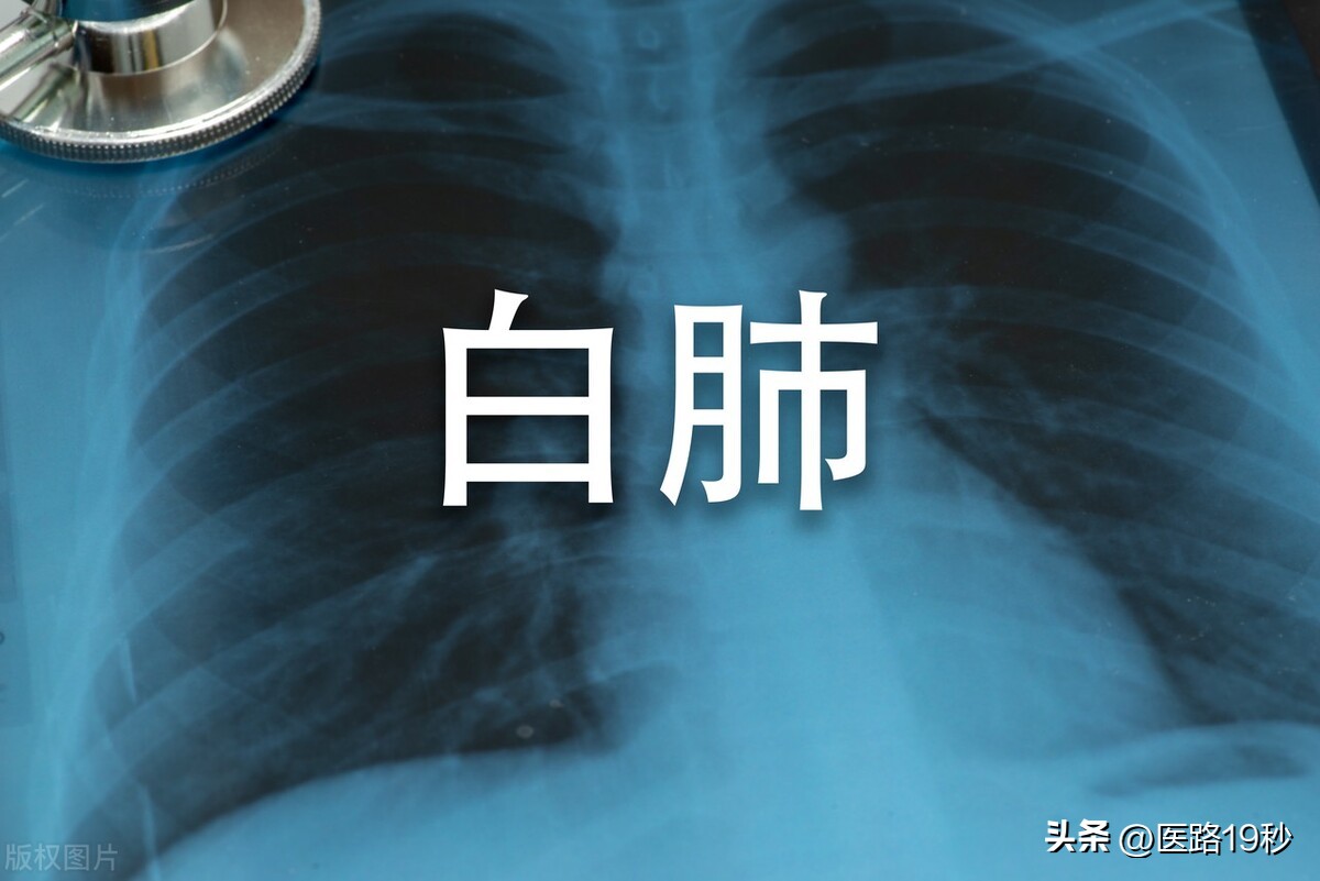 吃蒙脱石散能吃辅酶q10吗,蒙脱石散和辅酶q10