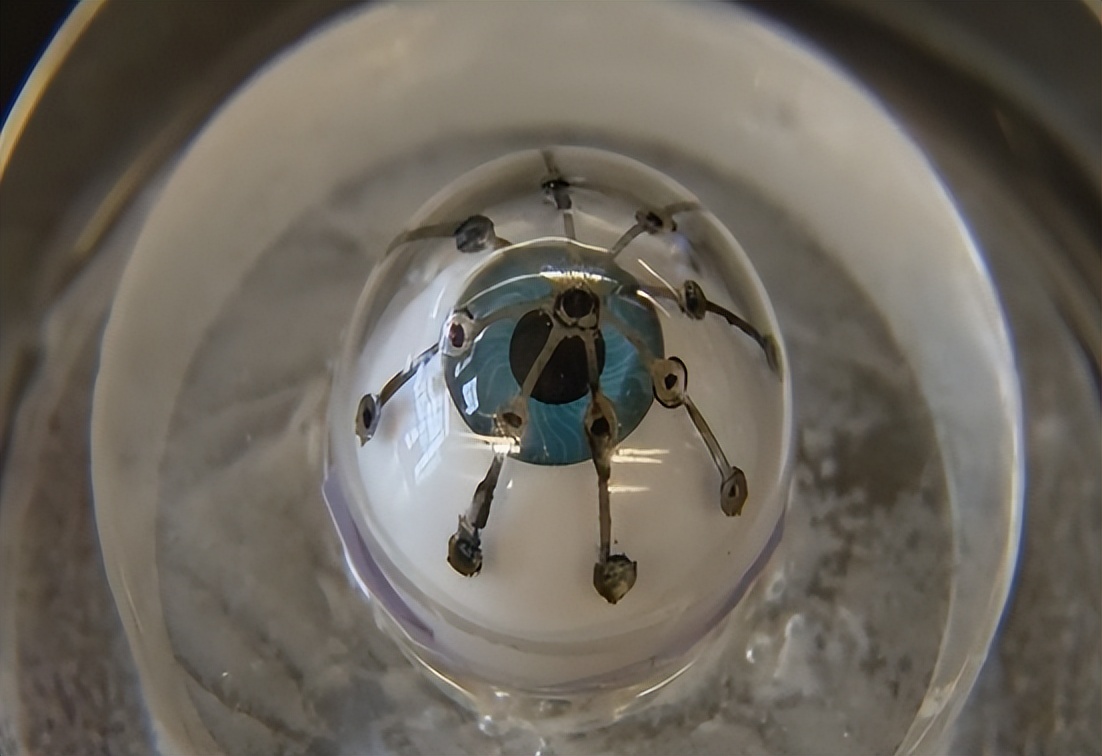 眼眶骨折怎么治疗,眼眶骨折算几级轻伤