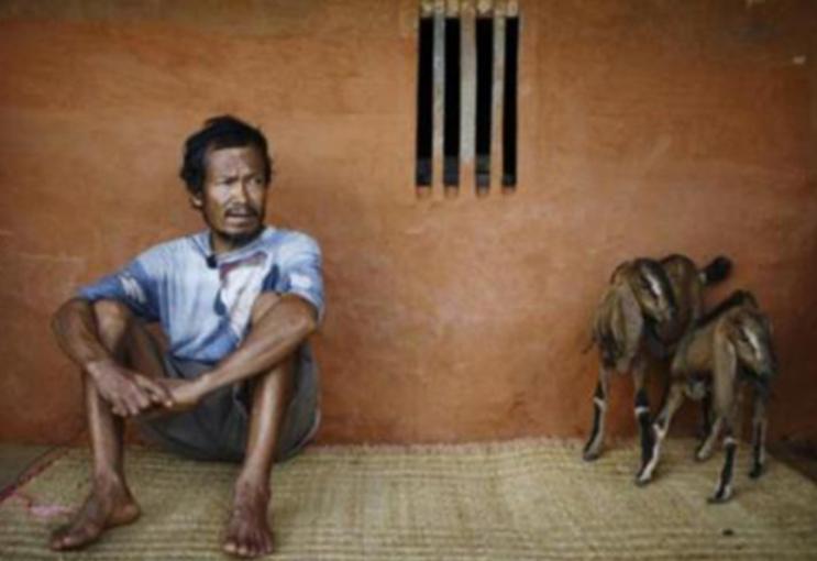 尼泊尔“肾谷”：村民拿命换钱，卖肾钱发财买房，人均身负一道疤