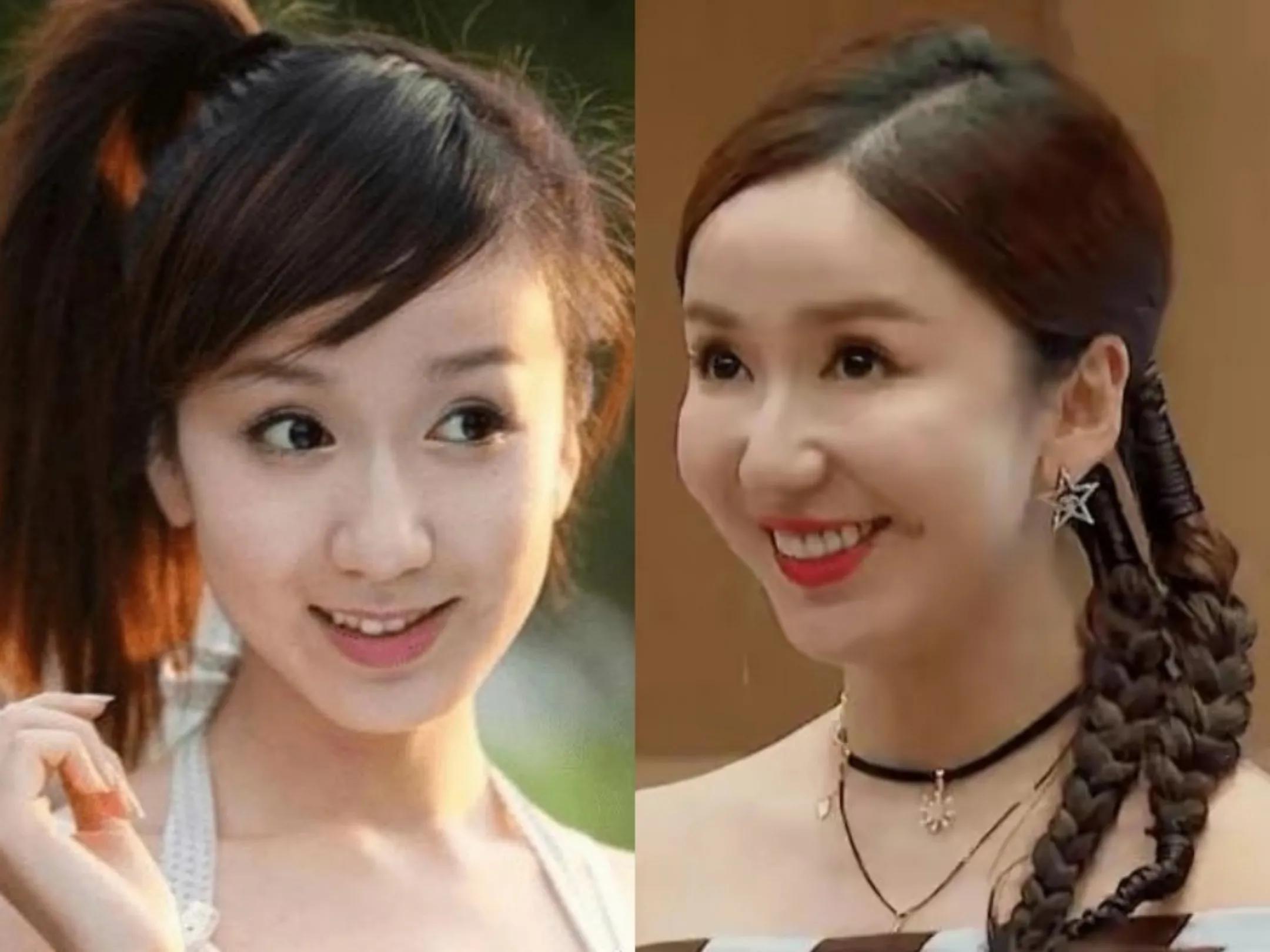 脸没恢复就别出来捞金，发面馒头、蜡像脸，求求你们放过观众吧！