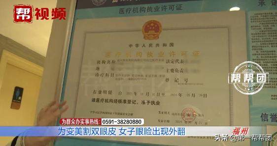 为了美整容整形的失败案例,90后割双眼皮亲身经历