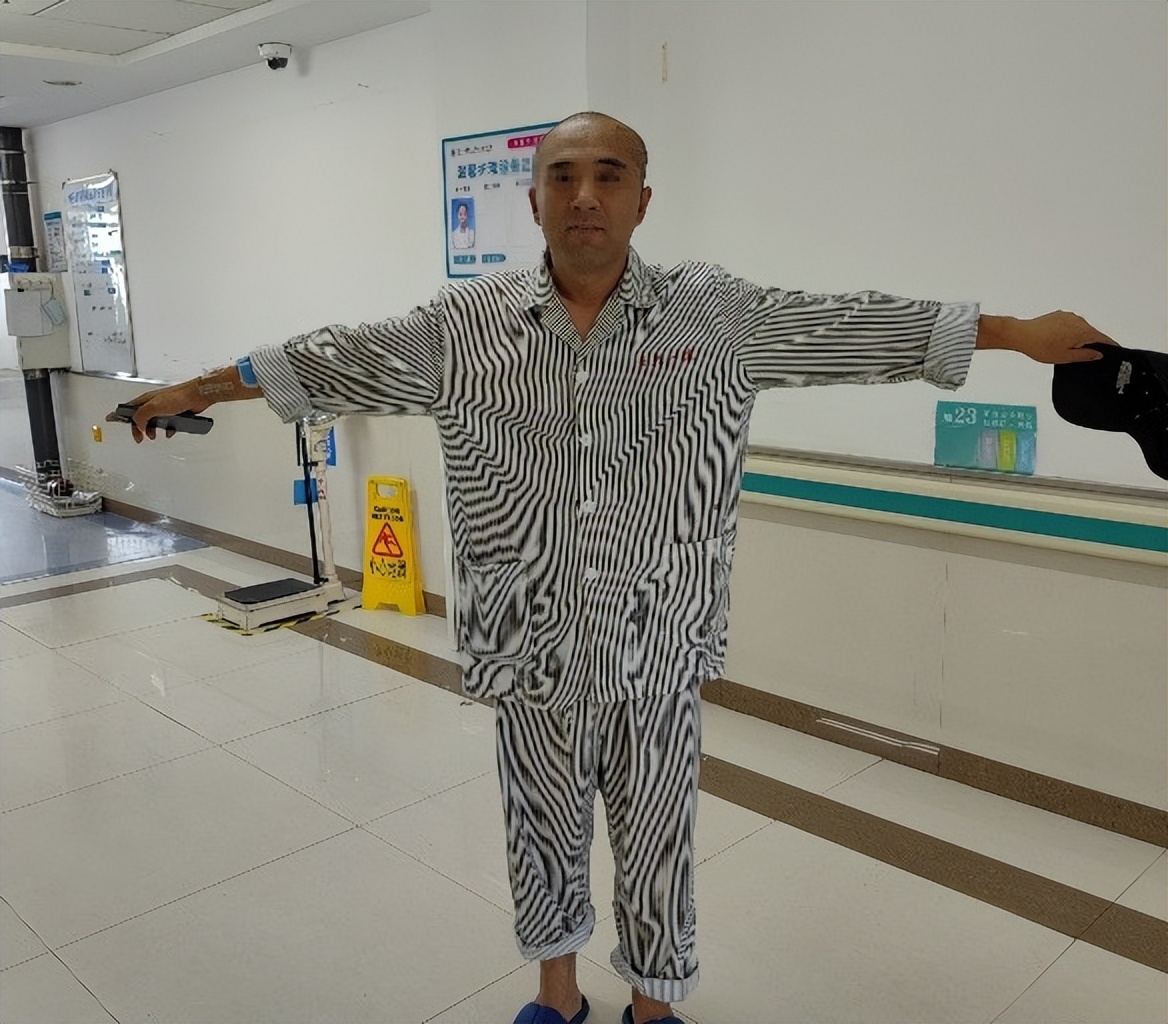 医大一院癫痫,癫痫频繁发作有良性癫痫的可能吗