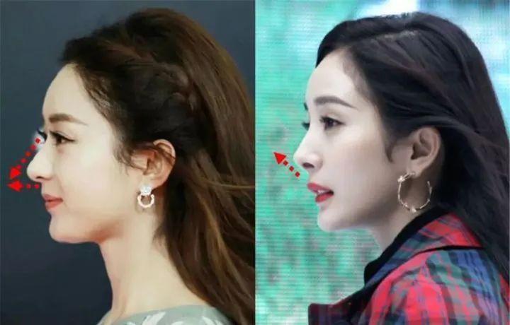 妈生鼻适合所有脸型吗,自然鼻和妈生鼻有什么区别