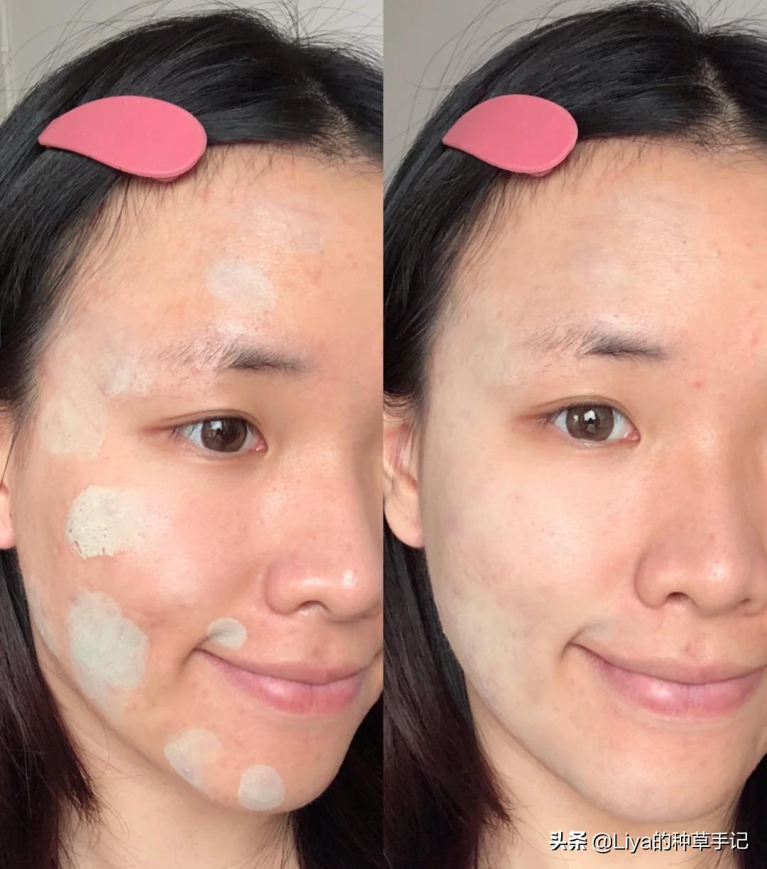 扁平脸如何拯救,扁平脸修复方法图解