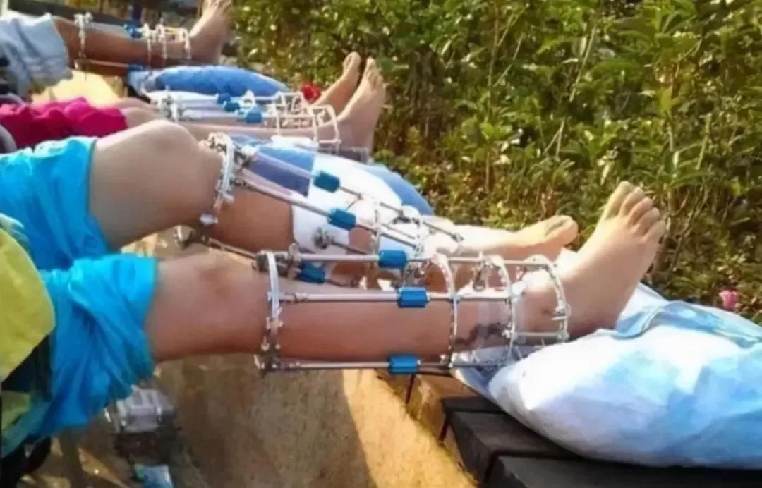 最科学的增高方法,如何增高最有效的方法20厘米